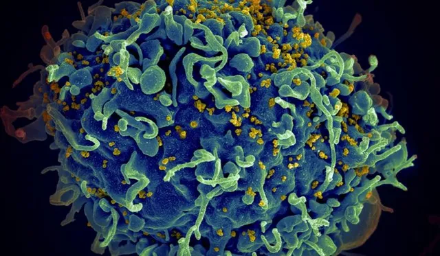 ‘Gamechanger’ HIV prevention drug to be made available cheaply in 120 countries