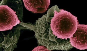 Cancer cells under microscope