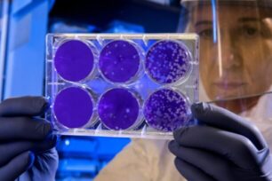 Researcher looking at petri dish