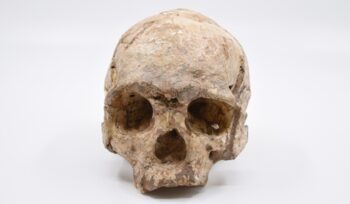 Dubois Collection skull